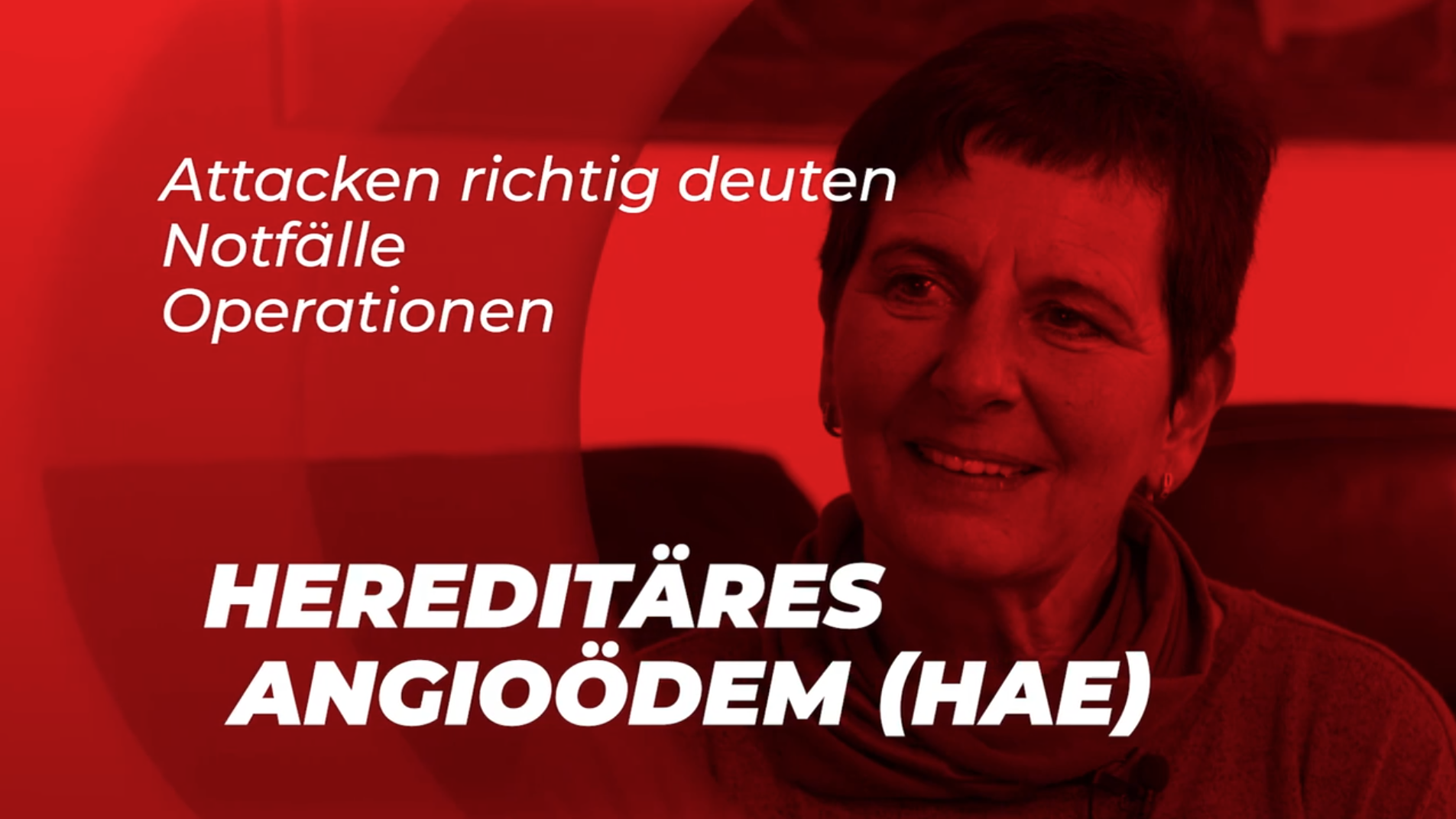 Attacken richtig deuten